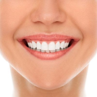 A woman is smiling while being at the dentist